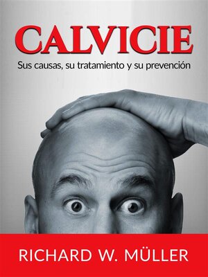 Calvicie (Traducido) - ebook